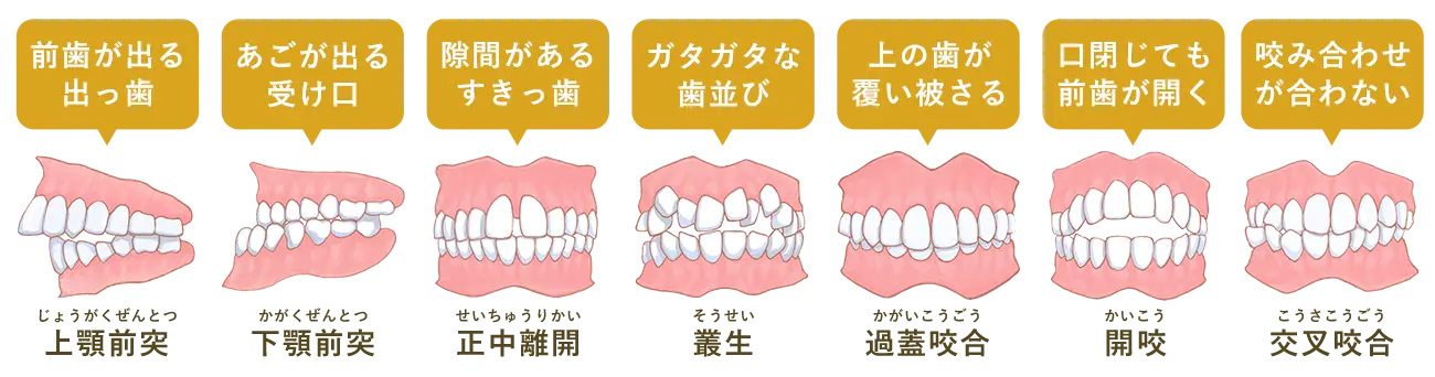矯正歯科