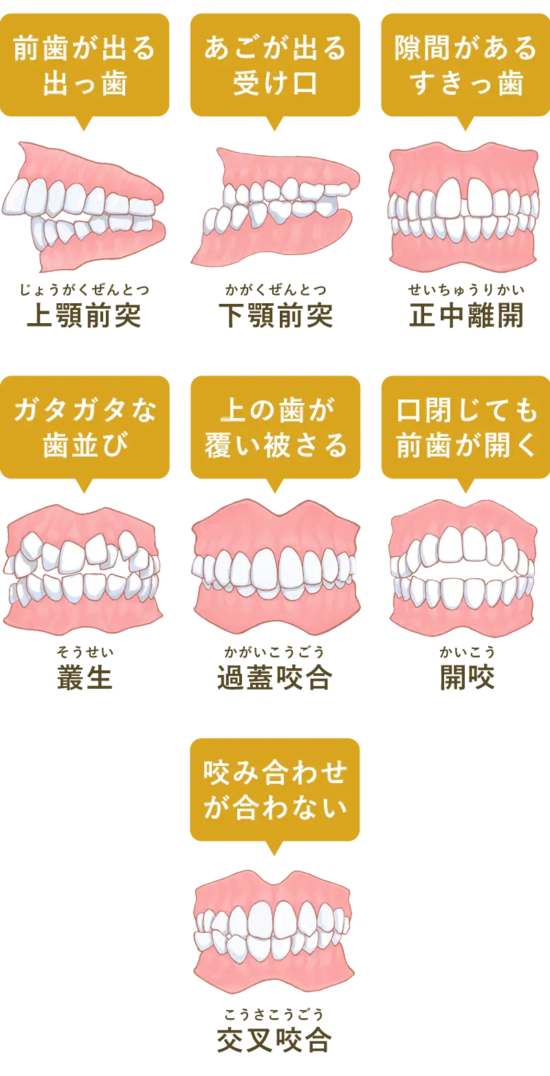 矯正歯科