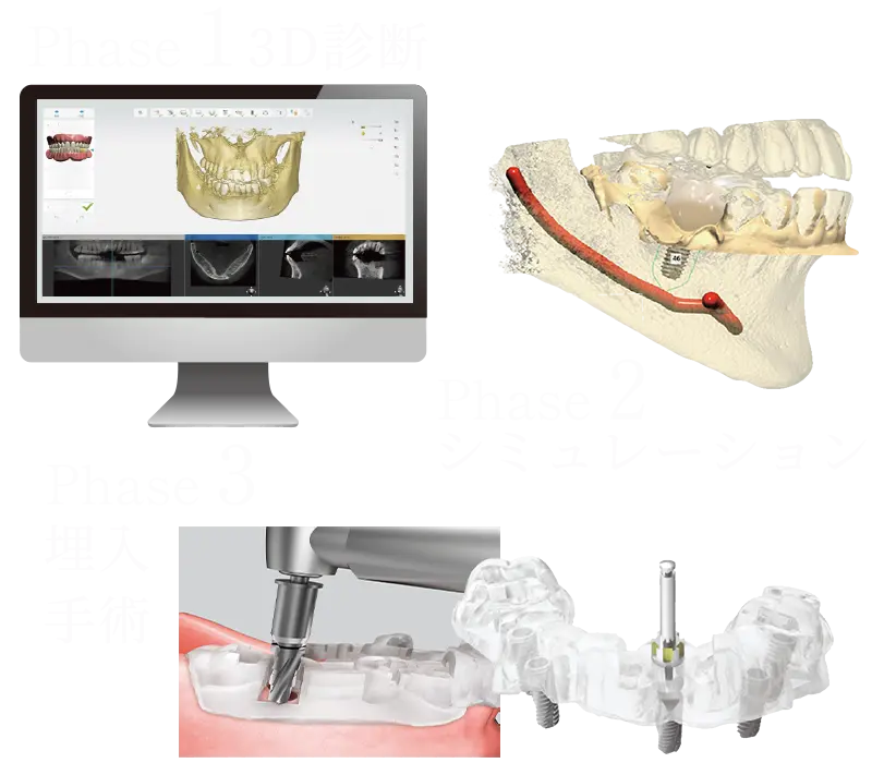 オステムワンガイド