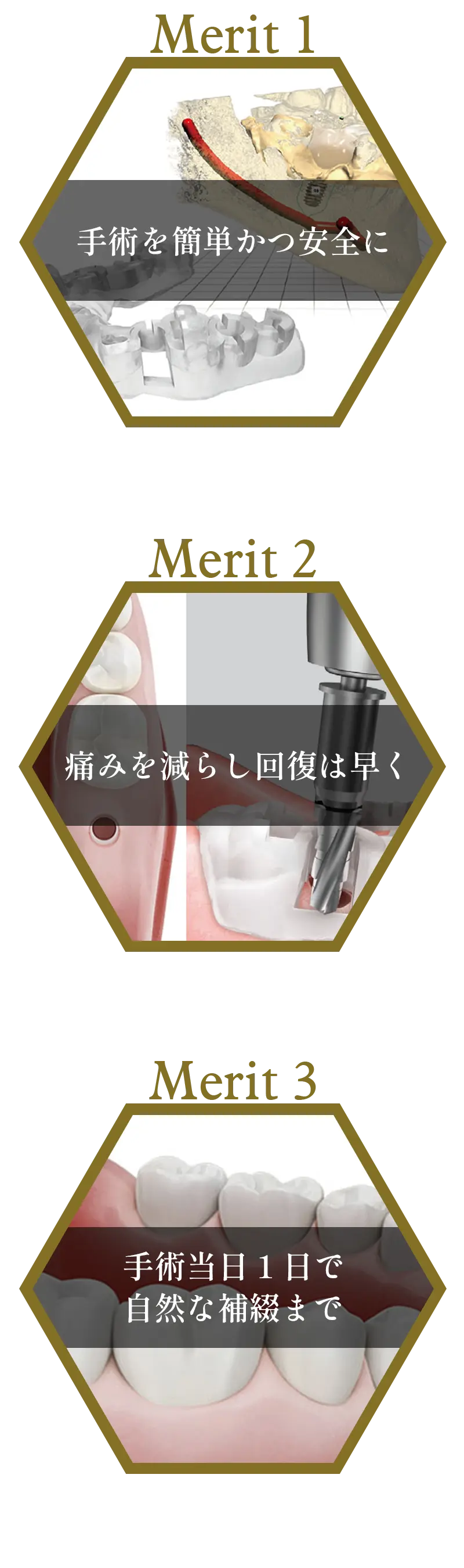 オステムワンガイドの特長