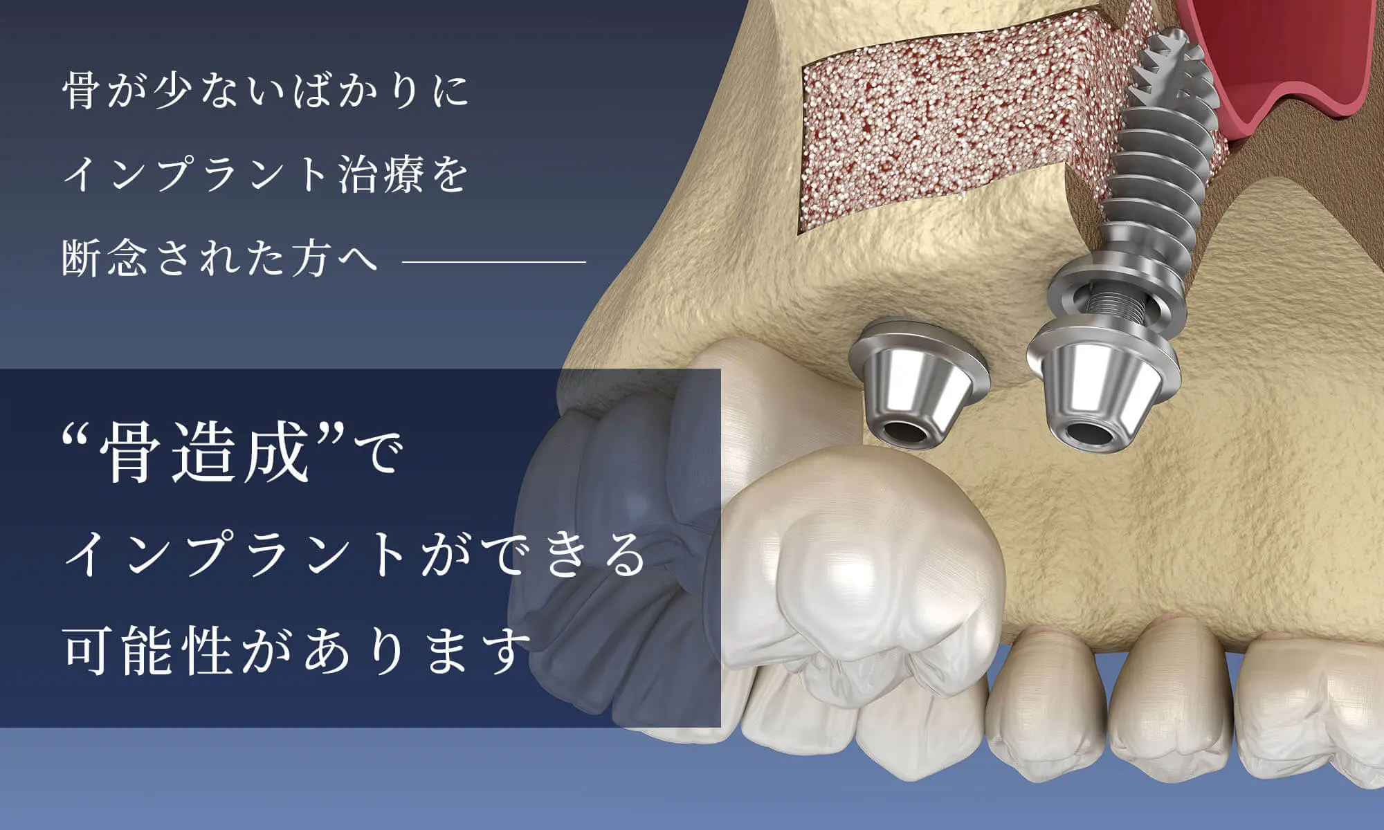 門真 骨造成