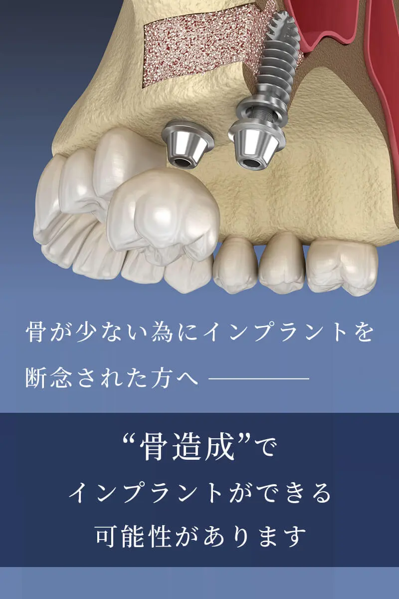 門真 骨造成